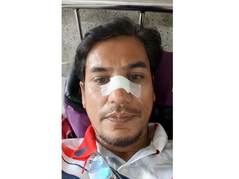 তেমুখী পয়েন্টে সাংবাদিককে কুপিয়ে নগদ টাকা ও মোবাইল ছিনতাই